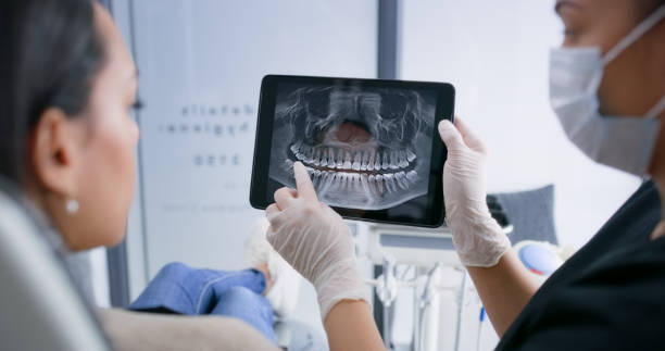 Licensed Tooth Extraction service in Haltom City, TX - Smile Center Dentistry